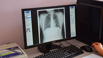Юные пациенты Каневского района смогут проходить рентгенологические исследования на новом цифровом аппарате